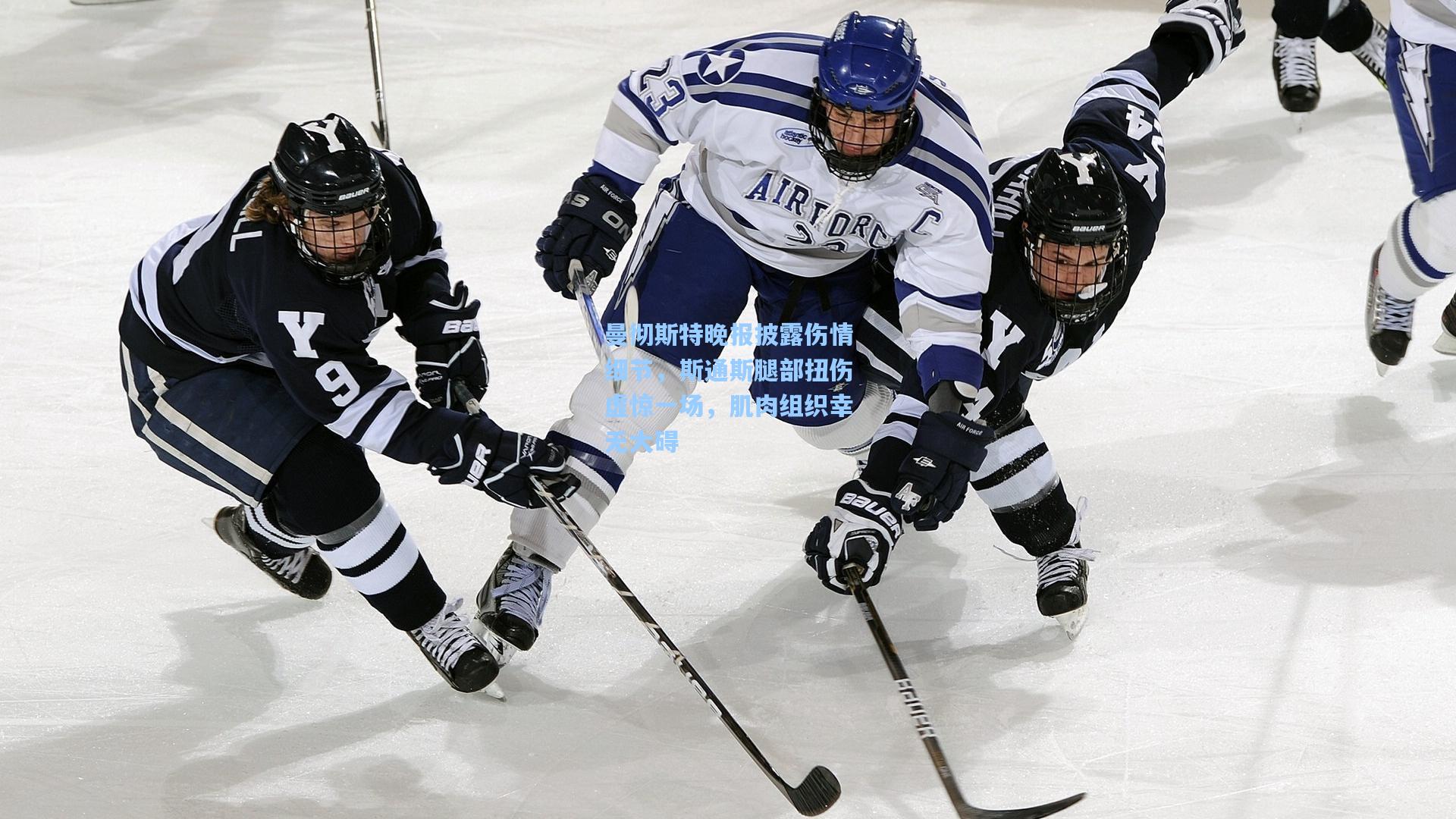 曼彻斯特晚报披露伤情细节，斯通斯腿部扭伤虚惊一场，肌肉组织幸无大碍